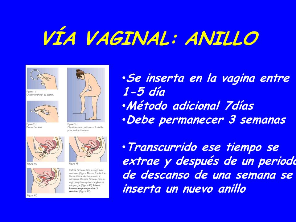 VÍA VAGINAL: ANILLO Se inserta en la vagina entre 1-5 día