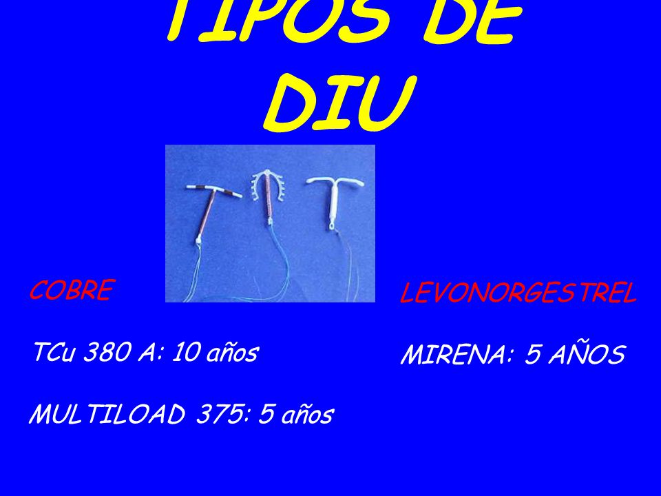 TIPOS DE DIU COBRE LEVONORGESTREL TCu 380 A: 10 años MIRENA: 5 AÑOS