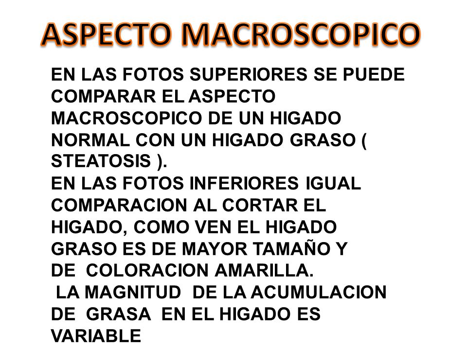ASPECTO MACROSCOPICO EN LAS FOTOS SUPERIORES SE PUEDE COMPARAR EL ASPECTO MACROSCOPICO DE UN HIGADO NORMAL CON UN HIGADO GRASO ( STEATOSIS ).