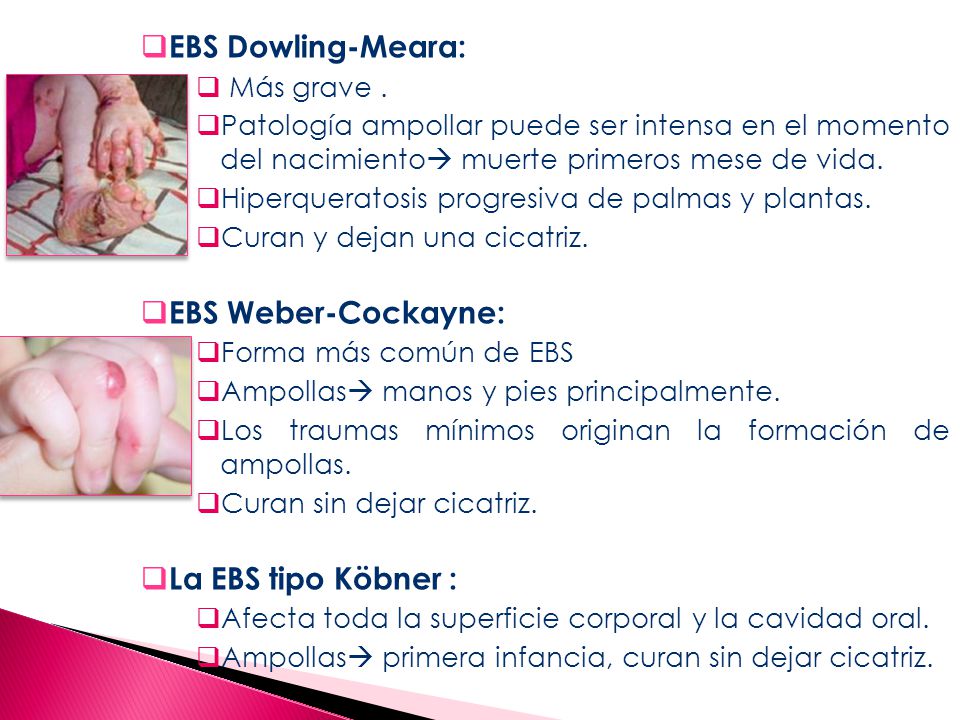 EBS Dowling-Meara: EBS Weber-Cockayne: La EBS tipo Köbner :