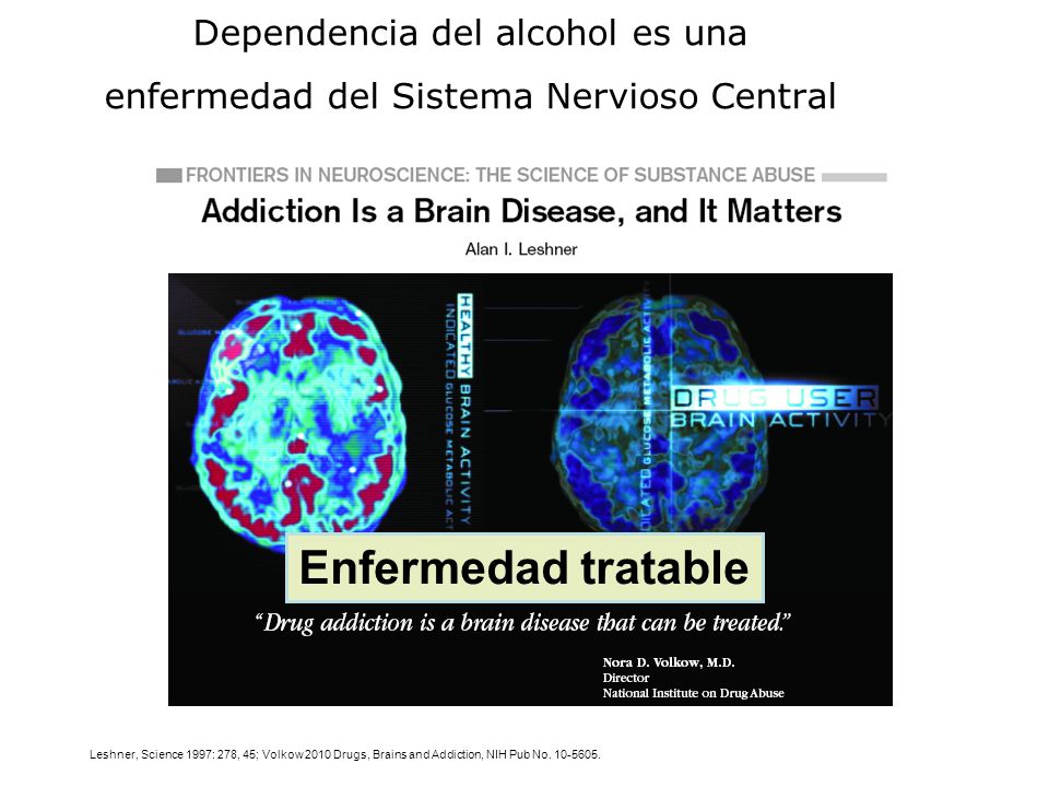 Dependencia del alcohol es una enfermedad del Sistema Nervioso Central
