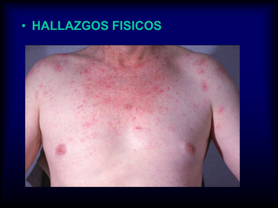 HALLAZGOS FISICOS