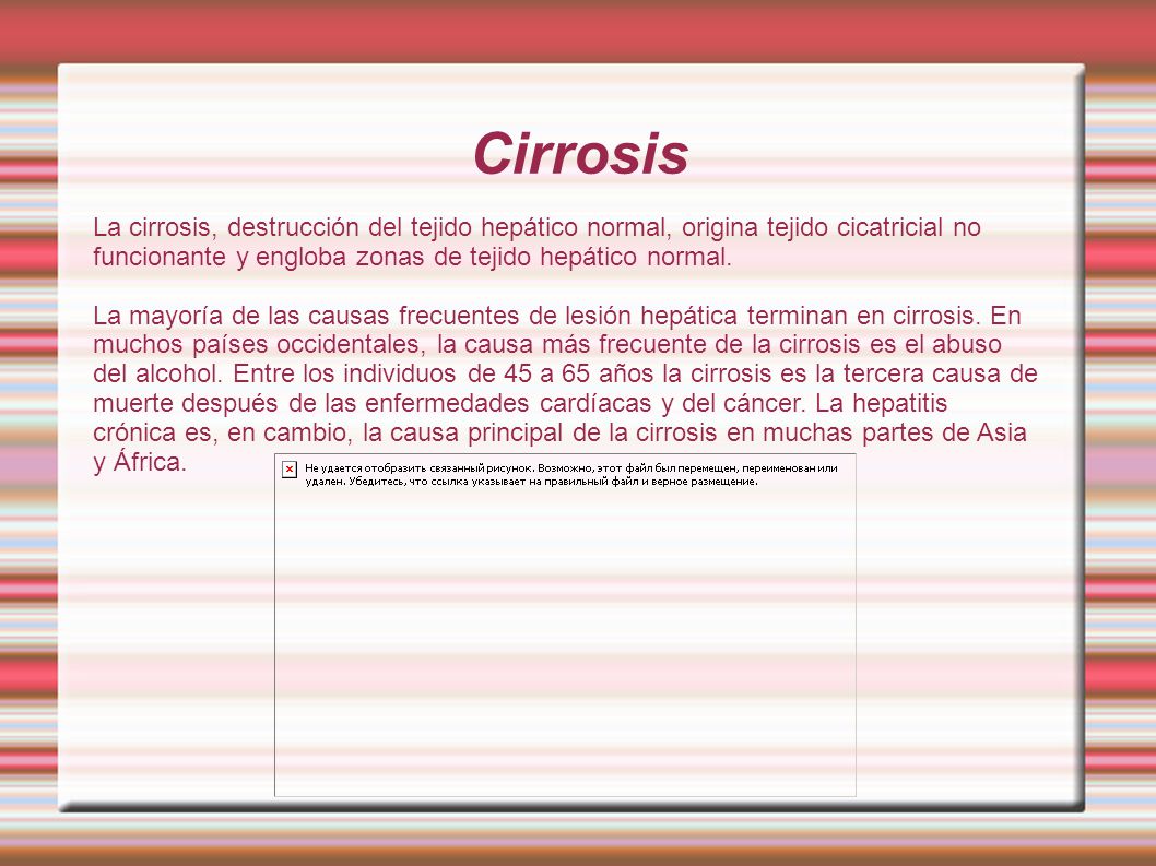 Cirrosis La cirrosis, destrucción del tejido hepático normal, origina tejido cicatricial no funcionante y engloba zonas de tejido hepático normal.