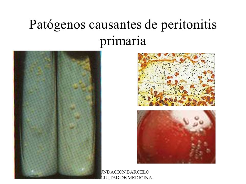 Patógenos causantes de peritonitis primaria