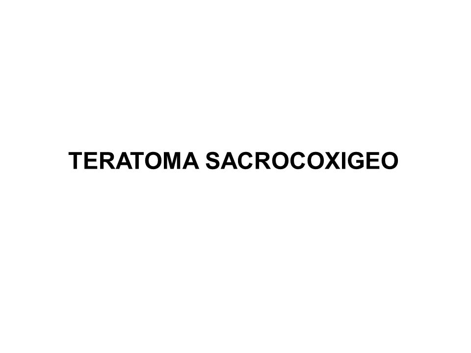 TERATOMA SACROCOXIGEO