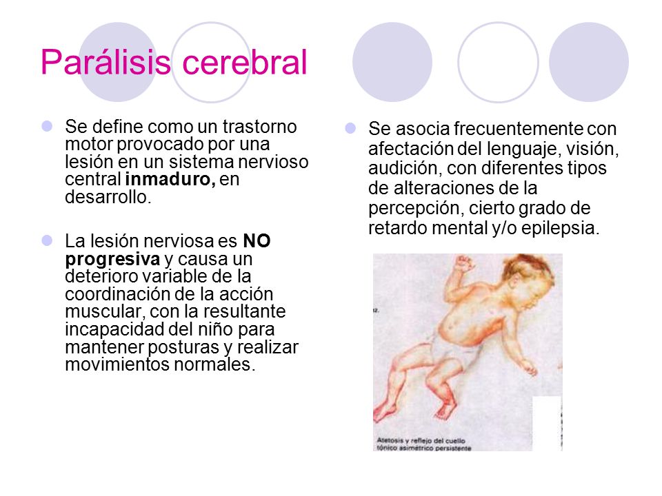 Parálisis cerebral Se define como un trastorno motor provocado por una lesión en un sistema nervioso central inmaduro, en desarrollo.