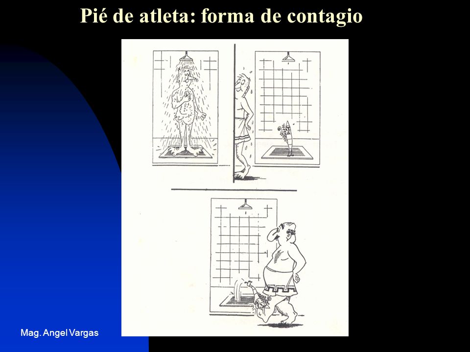 Pié de atleta: forma de contagio