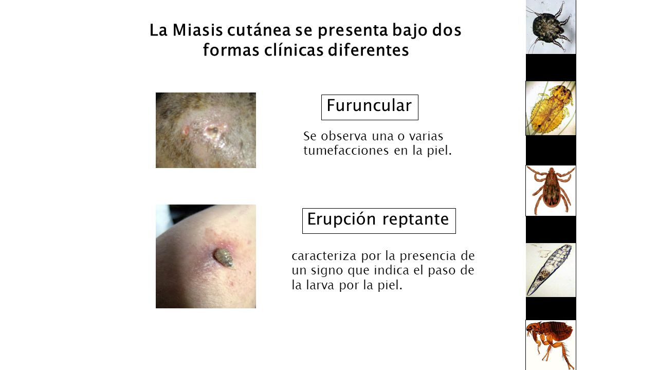 La Miasis cutánea se presenta bajo dos formas clínicas diferentes