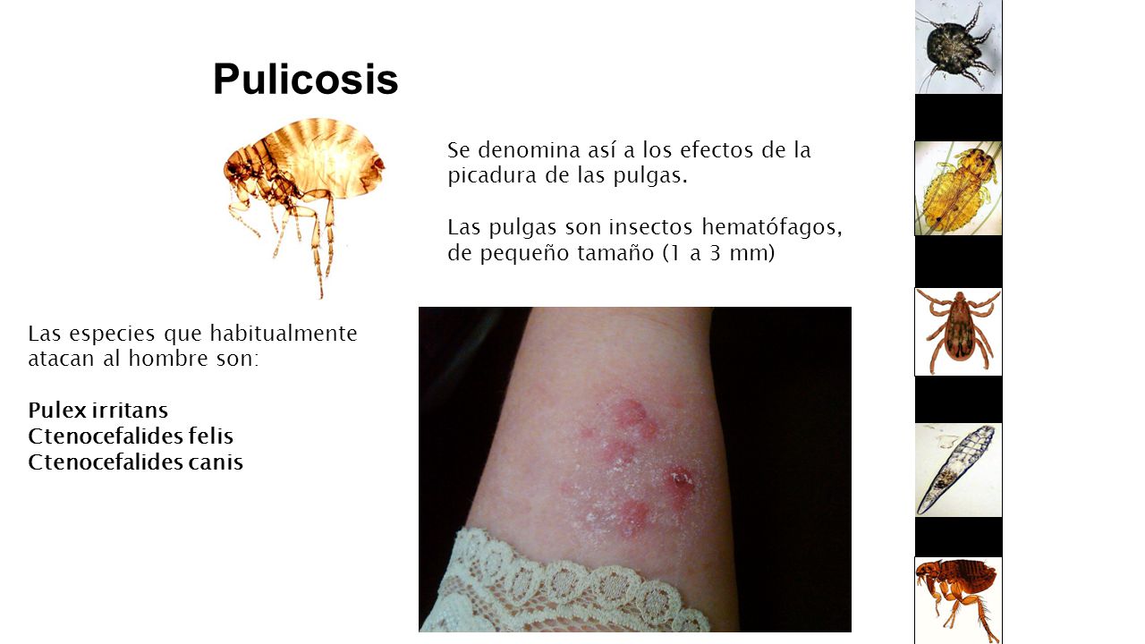 Pulicosis Se denomina así a los efectos de la picadura de las pulgas.