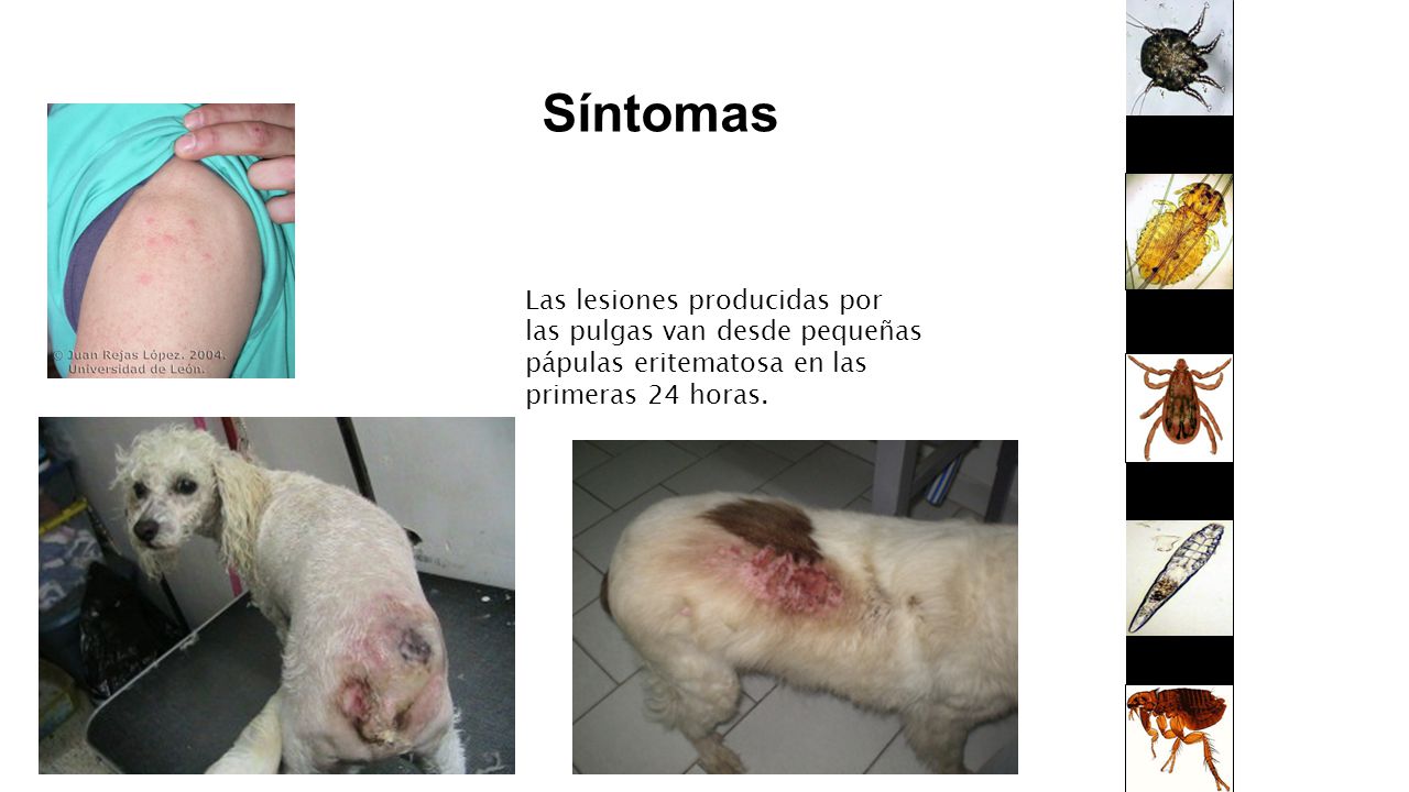 Síntomas Las lesiones producidas por las pulgas van desde pequeñas pápulas eritematosa en las primeras 24 horas.