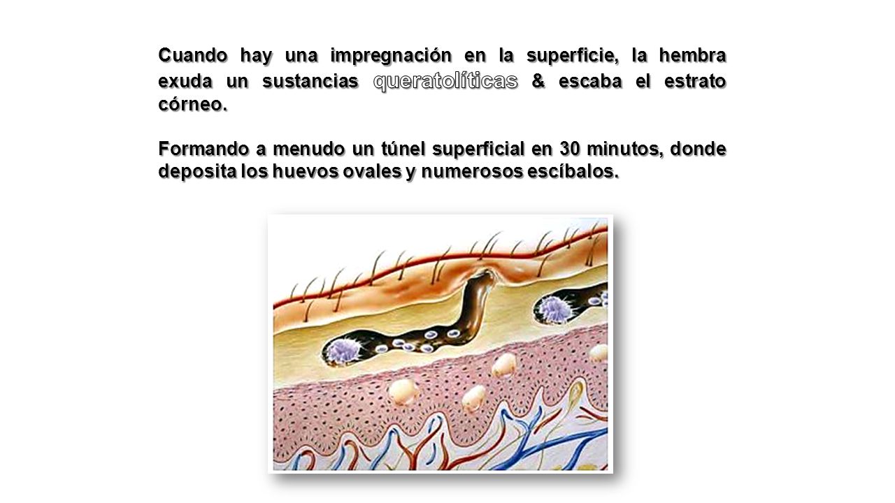 Cuando hay una impregnación en la superficie, la hembra exuda un sustancias queratolíticas & escaba el estrato córneo.