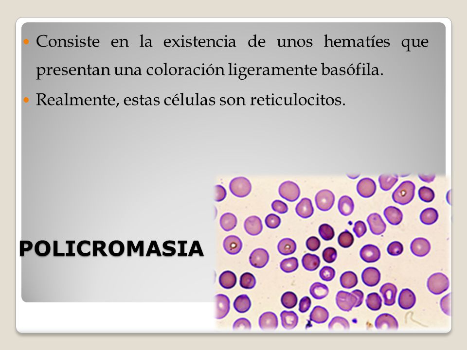 Consiste en la existencia de unos hematíes que presentan una coloración ligeramente basófila.