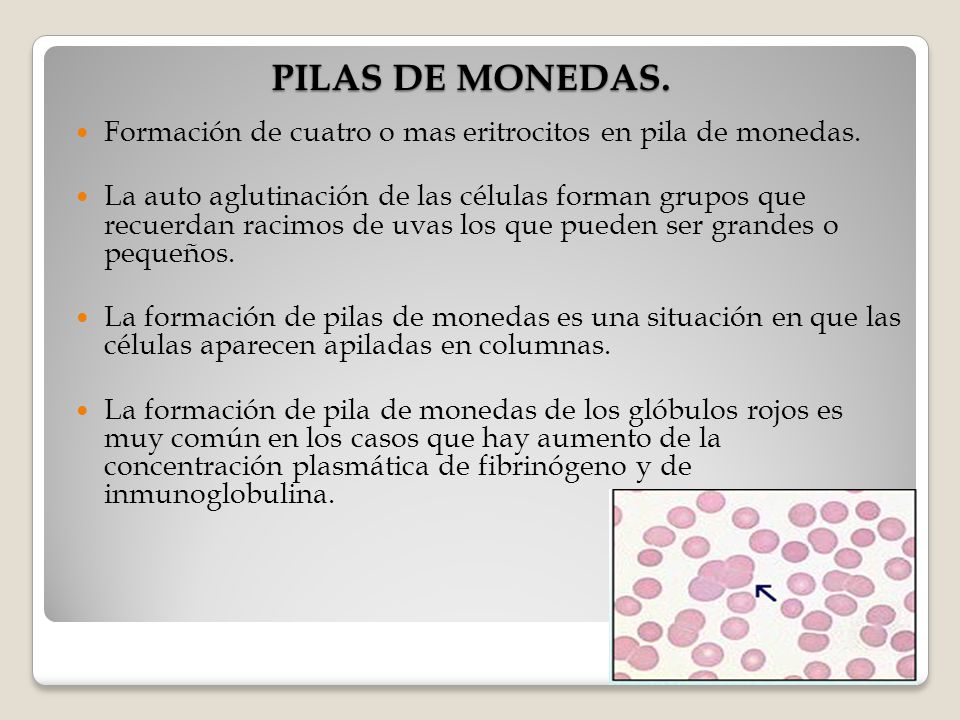 PILAS DE MONEDAS. Formación de cuatro o mas eritrocitos en pila de monedas.
