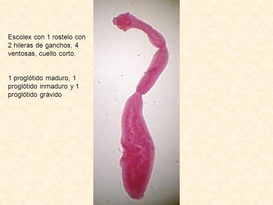 Escolex con 1 rostelo con 2 hileras de ganchos, 4 ventosas, cuello corto.