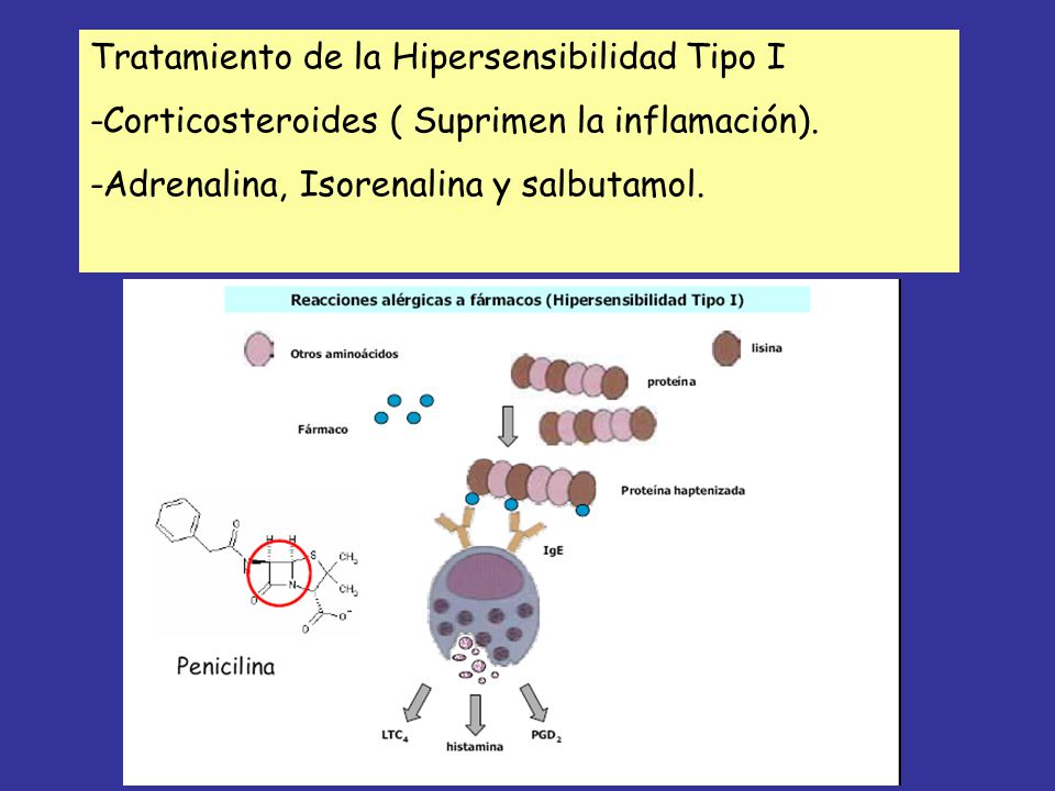 Tratamiento de la Hipersensibilidad Tipo I