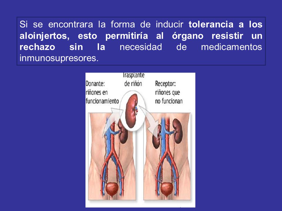 Si se encontrara la forma de inducir tolerancia a los aloinjertos, esto permitiría al órgano resistir un rechazo sin la necesidad de medicamentos inmunosupresores.