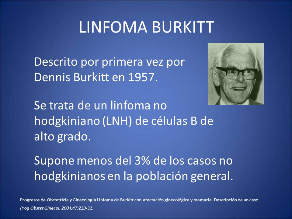 LINFOMA BURKITT Descrito por primera vez por Dennis Burkitt en 1957.