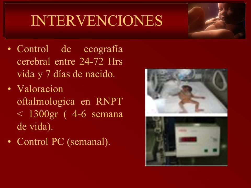 INTERVENCIONES Control de ecografía cerebral entre Hrs vida y 7 días de nacido.