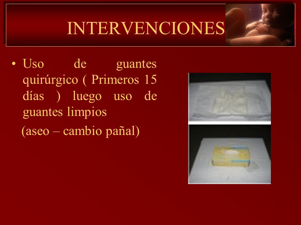 INTERVENCIONES Uso de guantes quirúrgico ( Primeros 15 días ) luego uso de guantes limpios.