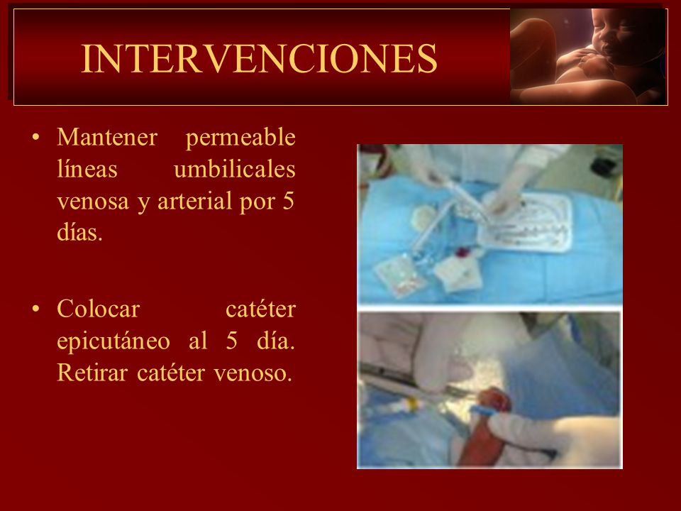 INTERVENCIONES Mantener permeable líneas umbilicales venosa y arterial por 5 días.