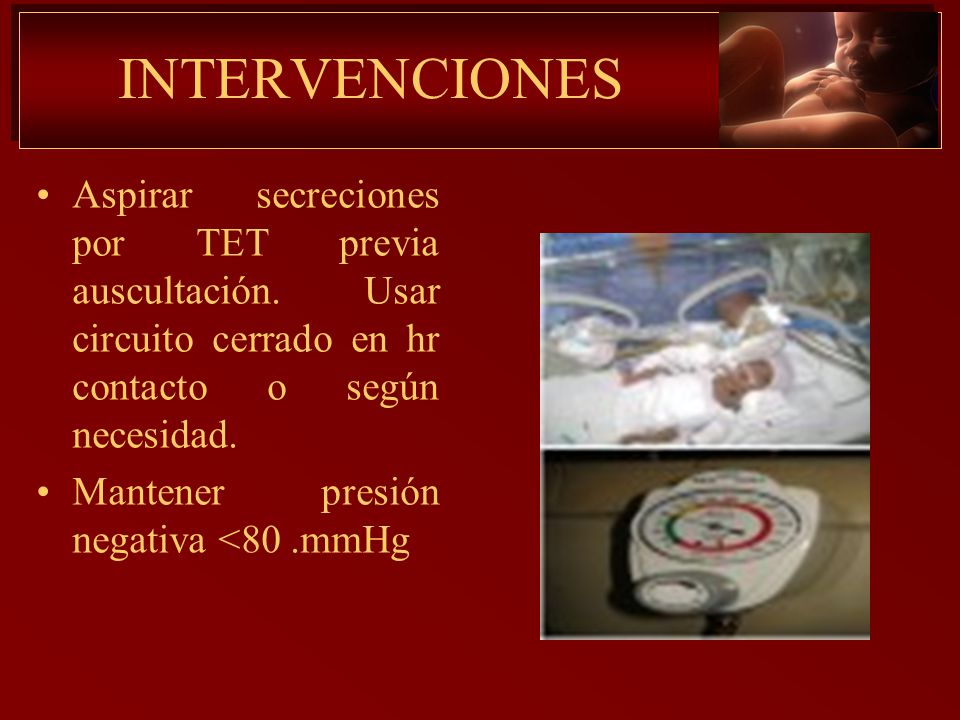 INTERVENCIONES Aspirar secreciones por TET previa auscultación. Usar circuito cerrado en hr contacto o según necesidad.