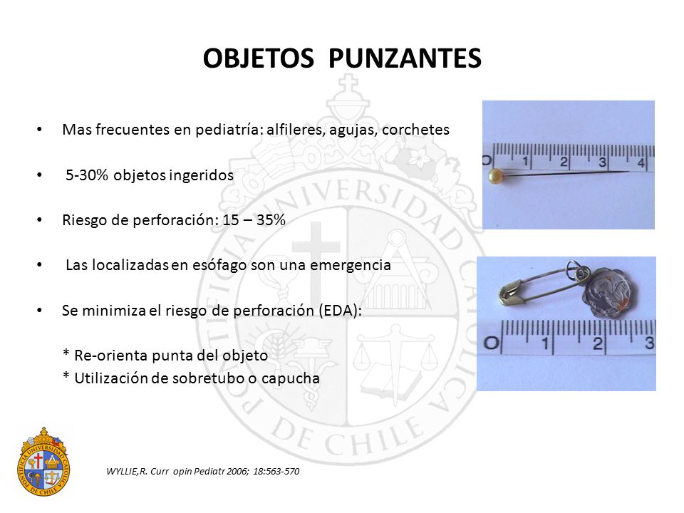 OBJETOS PUNZANTES Mas frecuentes en pediatría: alfileres, agujas, corchetes. 5-30% objetos ingeridos.