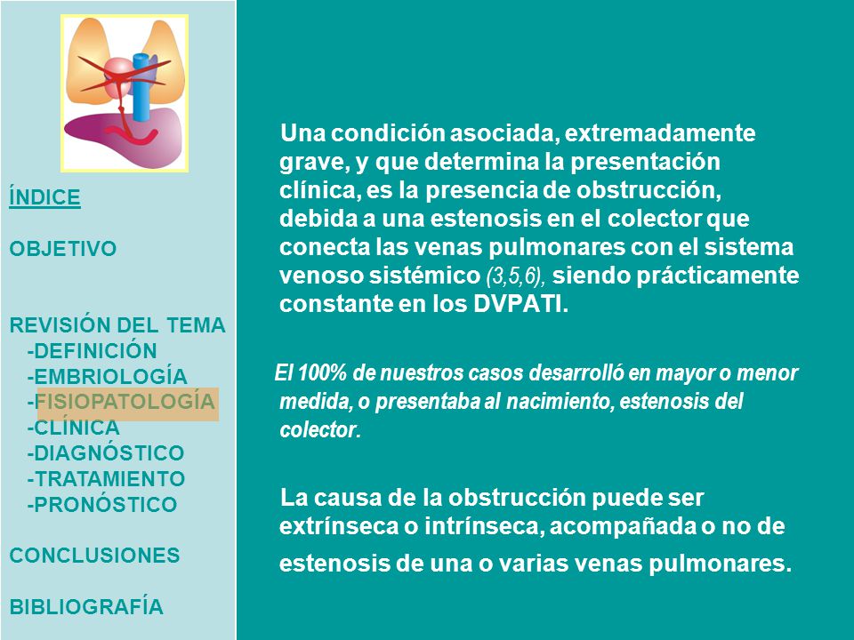 ÍNDICE OBJETIVO. REVISIÓN DEL TEMA. -DEFINICIÓN. -EMBRIOLOGÍA. -FISIOPATOLOGÍA. -CLÍNICA. -DIAGNÓSTICO.