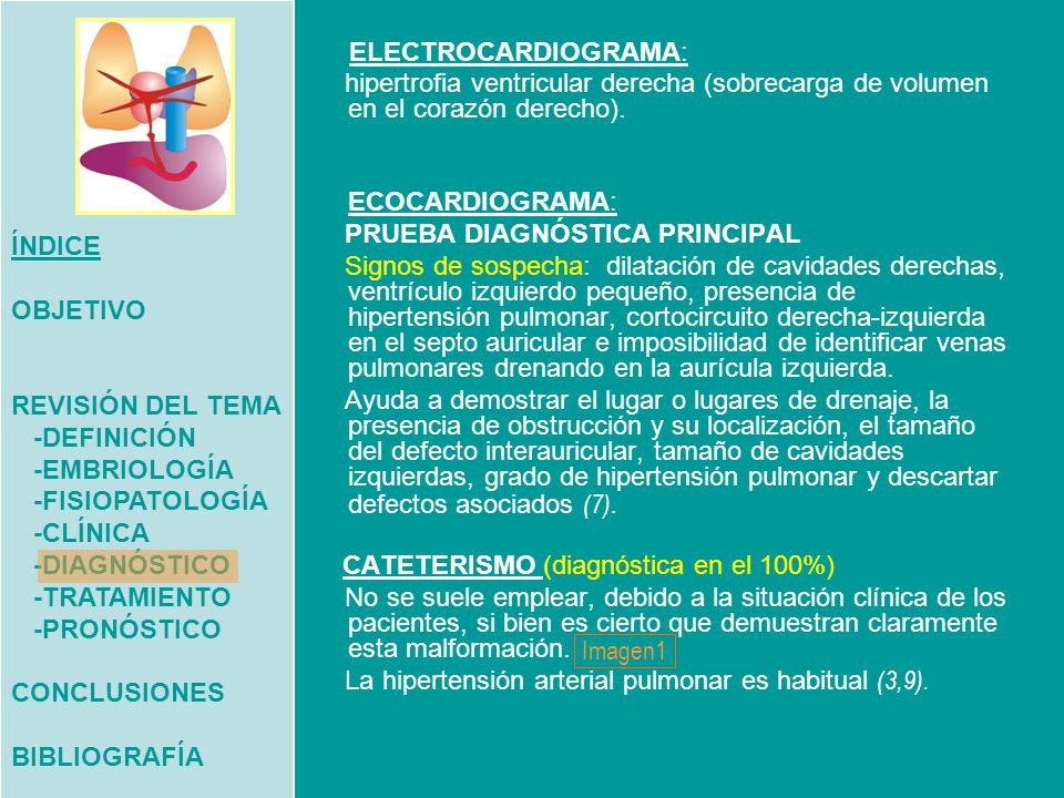 ÍNDICE OBJETIVO. REVISIÓN DEL TEMA. -DEFINICIÓN. -EMBRIOLOGÍA. -FISIOPATOLOGÍA. -CLÍNICA. -DIAGNÓSTICO.