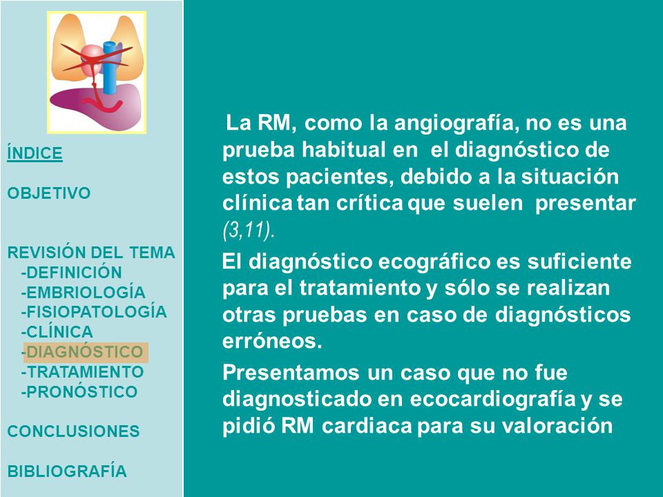 ÍNDICE OBJETIVO. REVISIÓN DEL TEMA. -DEFINICIÓN. -EMBRIOLOGÍA. -FISIOPATOLOGÍA. -CLÍNICA. -DIAGNÓSTICO.