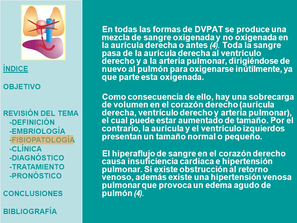 ÍNDICE OBJETIVO. REVISIÓN DEL TEMA. -DEFINICIÓN. -EMBRIOLOGÍA. -FISIOPATOLOGÍA. -CLÍNICA. -DIAGNÓSTICO.