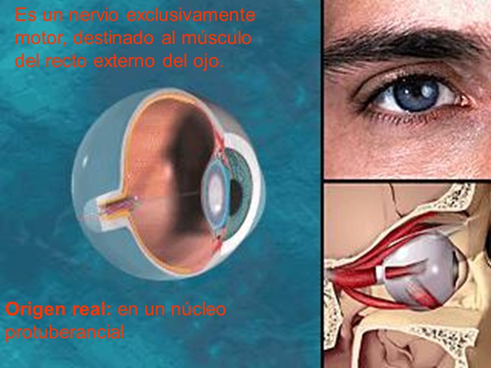Es un nervio exclusivamente motor, destinado al músculo del recto externo del ojo.