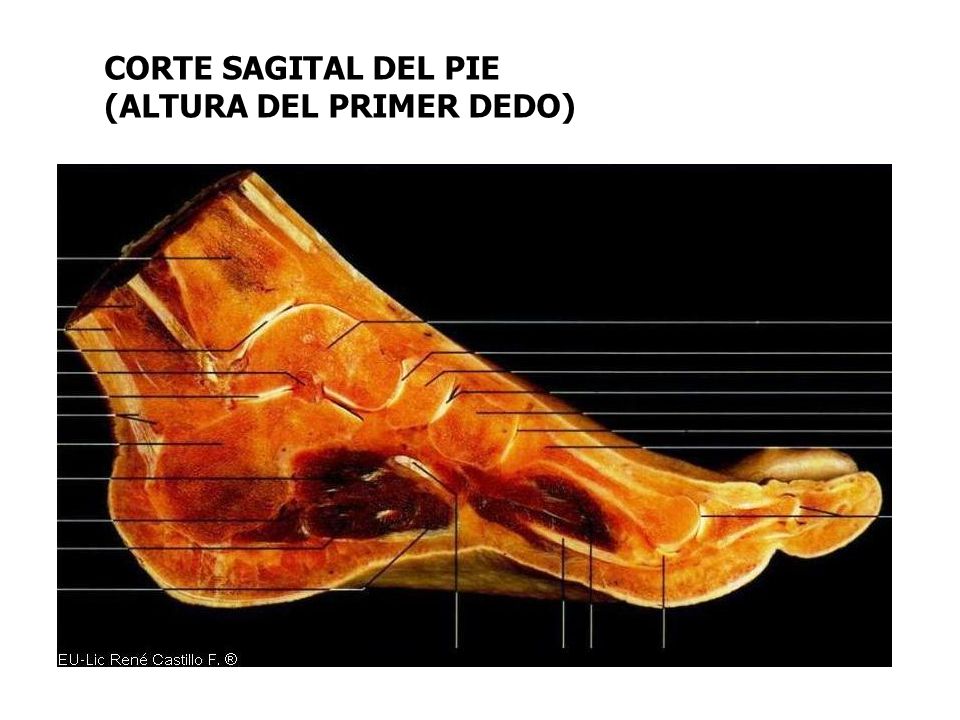 CORTE SAGITAL DEL PIE (ALTURA DEL PRIMER DEDO)