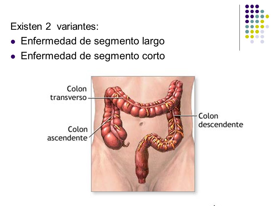 Enfermedad de segmento largo Enfermedad de segmento corto