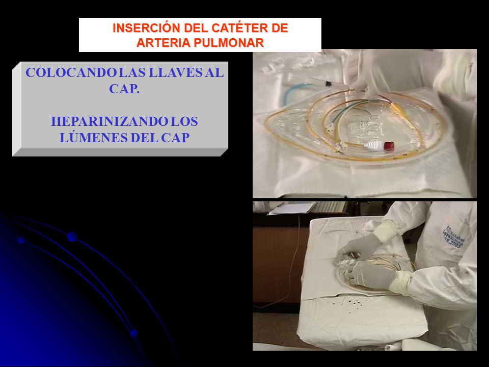 COLOCANDO LAS LLAVES AL CAP. HEPARINIZANDO LOS LÚMENES DEL CAP