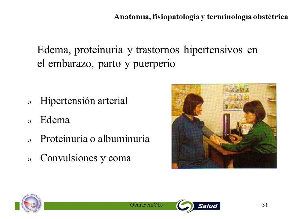 Edema, proteinuria y trastornos hipertensivos en el embarazo, parto y puerperio