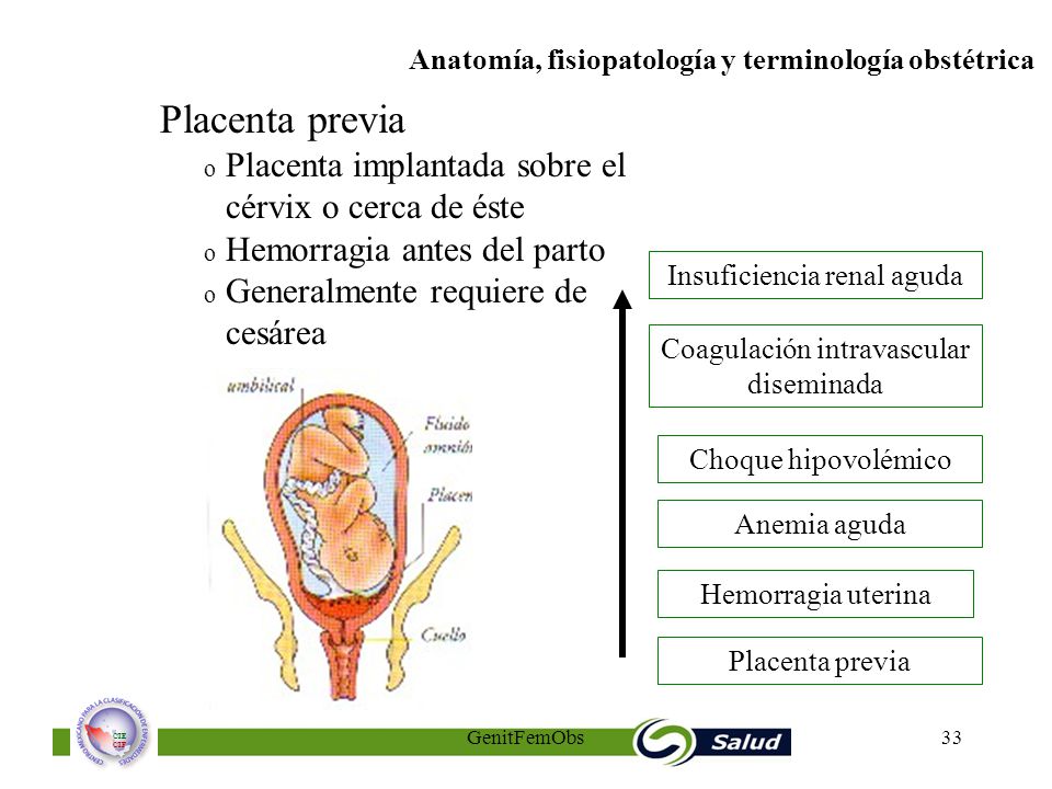 Placenta previa Placenta implantada sobre el cérvix o cerca de éste