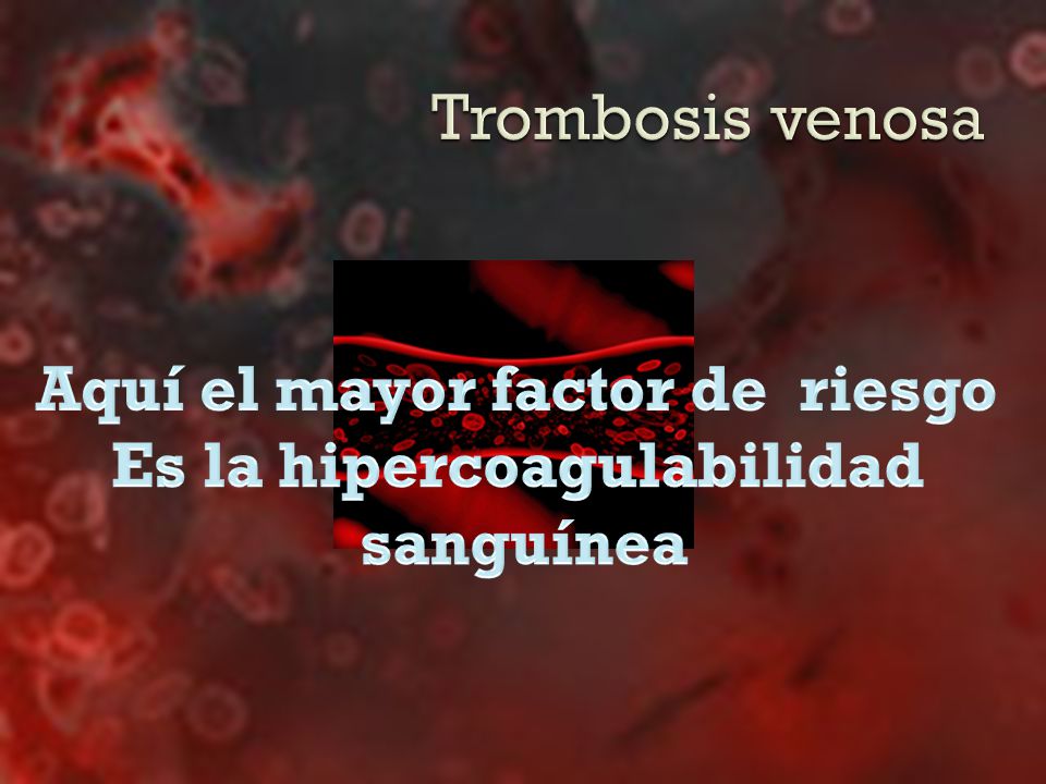 Aquí el mayor factor de riesgo Es la hipercoagulabilidad