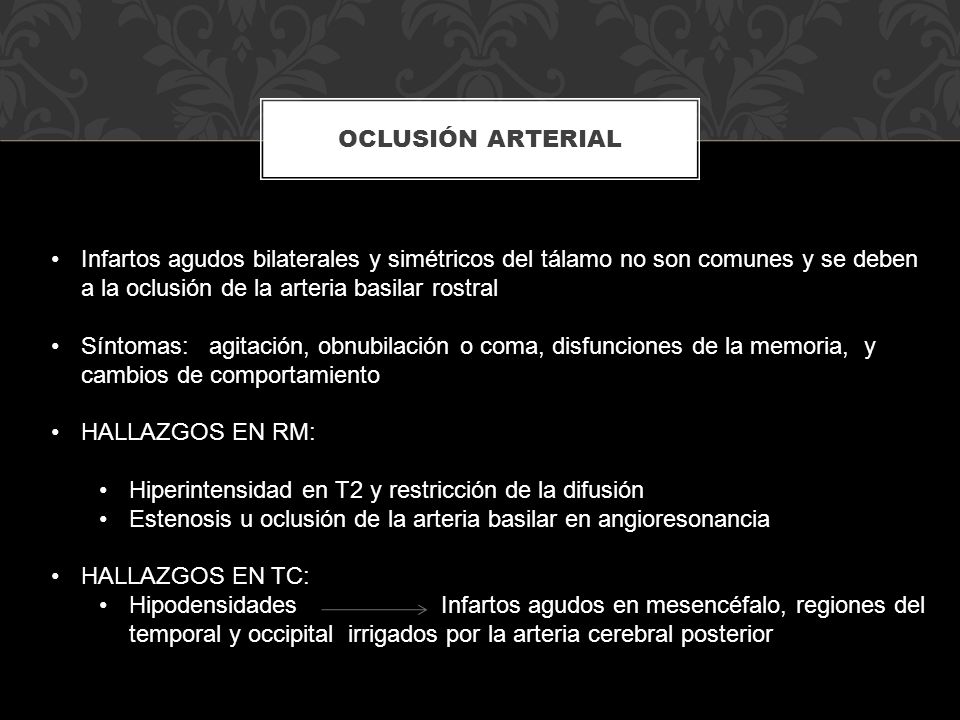 Oclusión arterial Infartos agudos bilaterales y simétricos del tálamo no son comunes y se deben a la oclusión de la arteria basilar rostral.