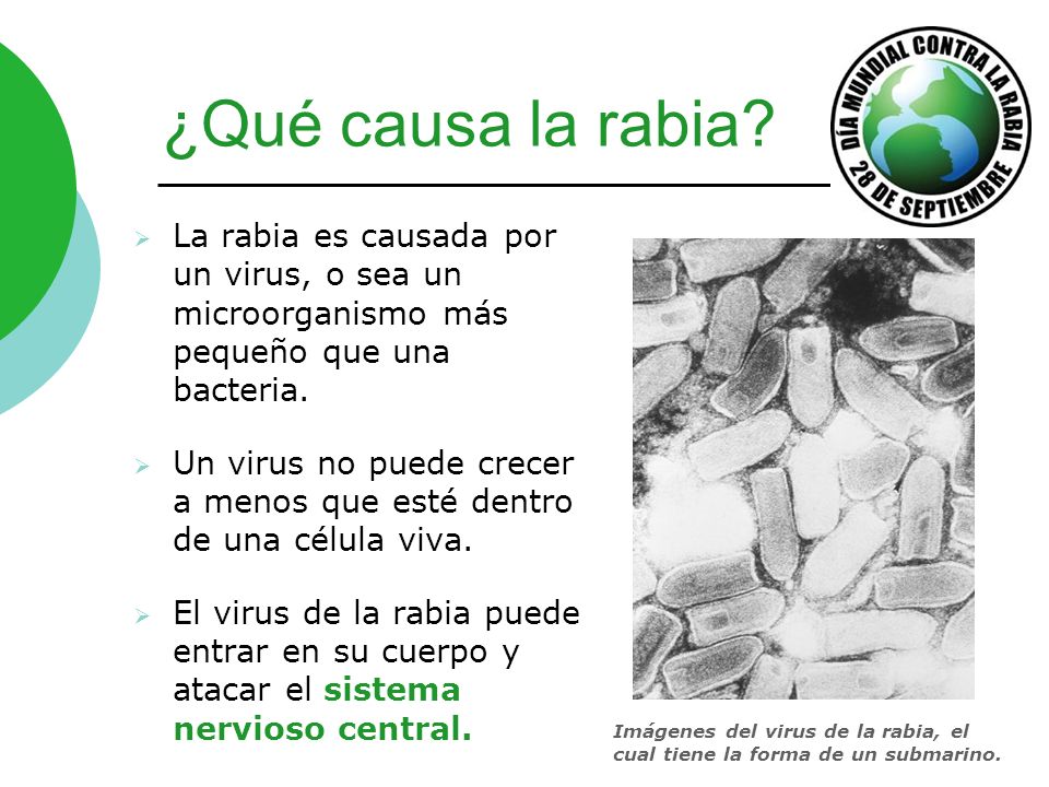 ¿Qué causa la rabia La rabia es causada por un virus, o sea un microorganismo más pequeño que una bacteria.