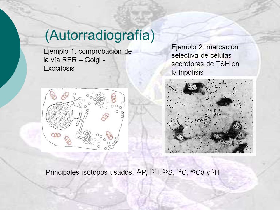 (Autorradiografía) Ejemplo 2: marcación selectiva de células secretoras de TSH en la hipófisis.