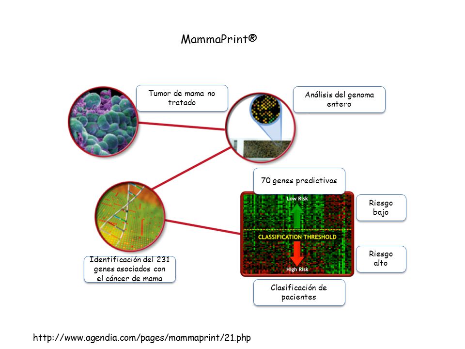 MammaPrint®