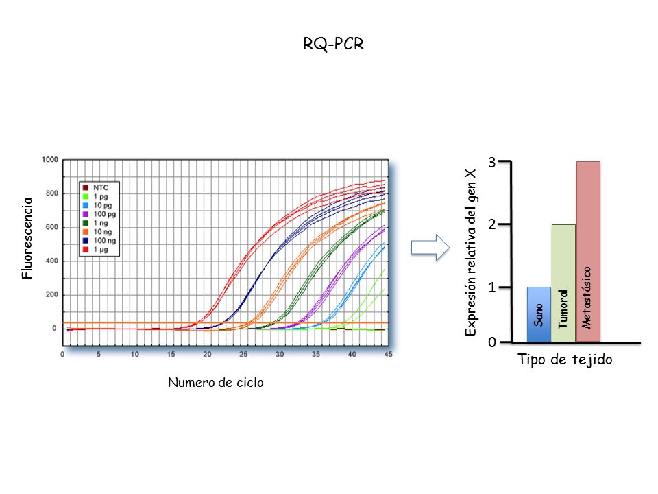 RQ-PCR Tipo de tejido Fluorescencia Expresión relativa del gen X