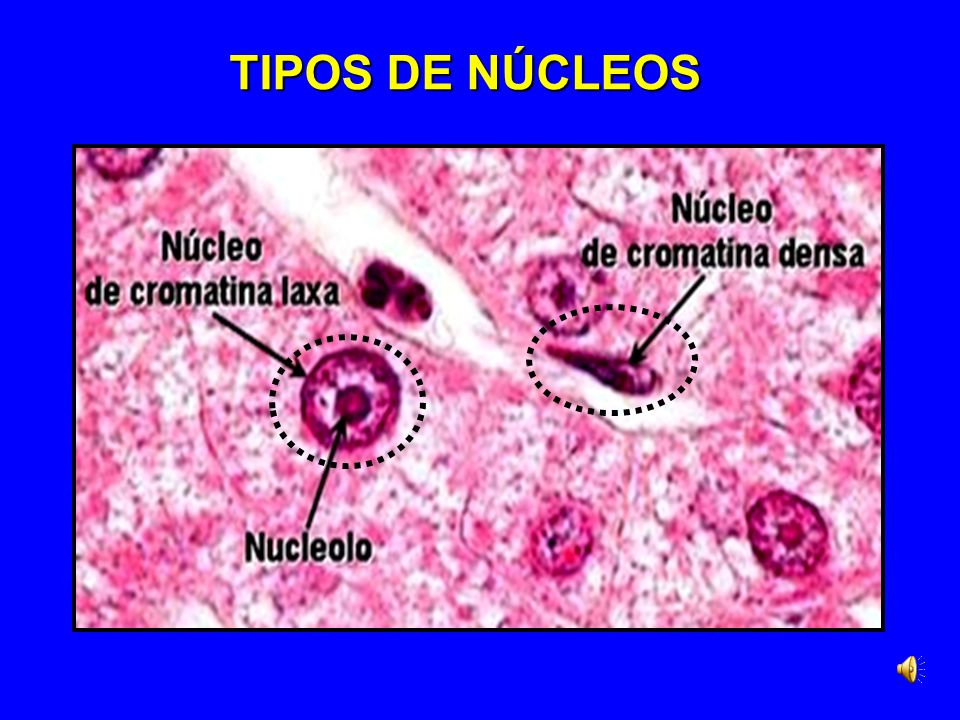 TIPOS DE NÚCLEOS Diapositiva 11. Orientadora 8. Primer Trimestre.