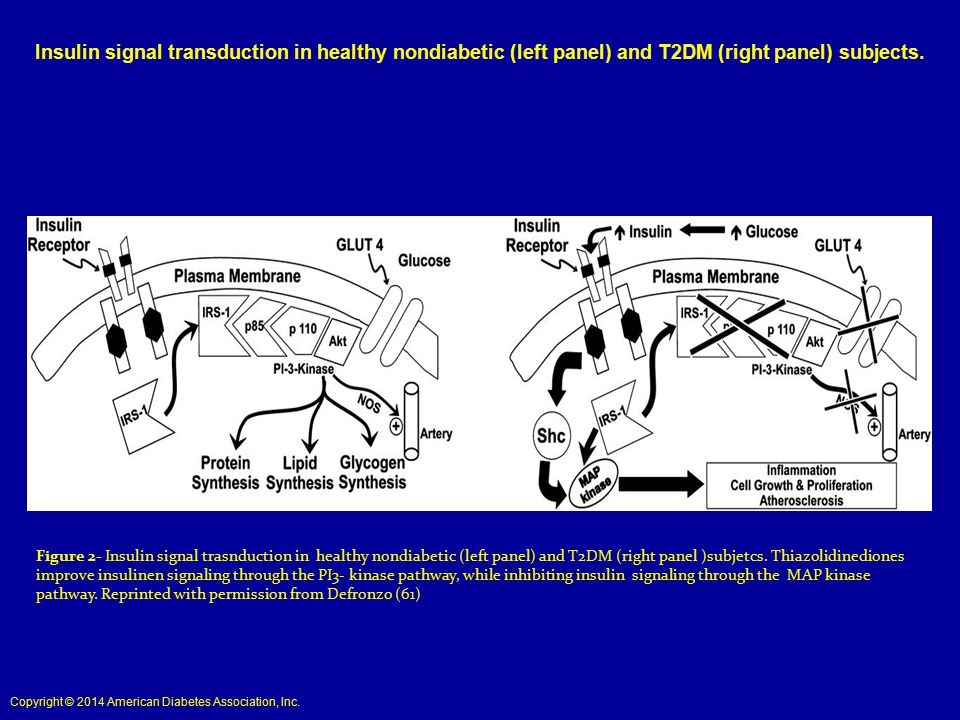 Insulin signal transduction in healthy nondiabetic (left panel) and T2DM (right panel) subjects.