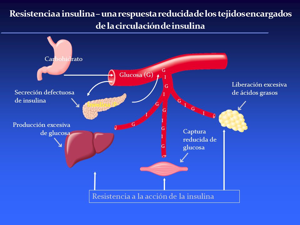 Resistencia a insulina – una respuesta reducida de los tejidos encargados de la circulación de insulina