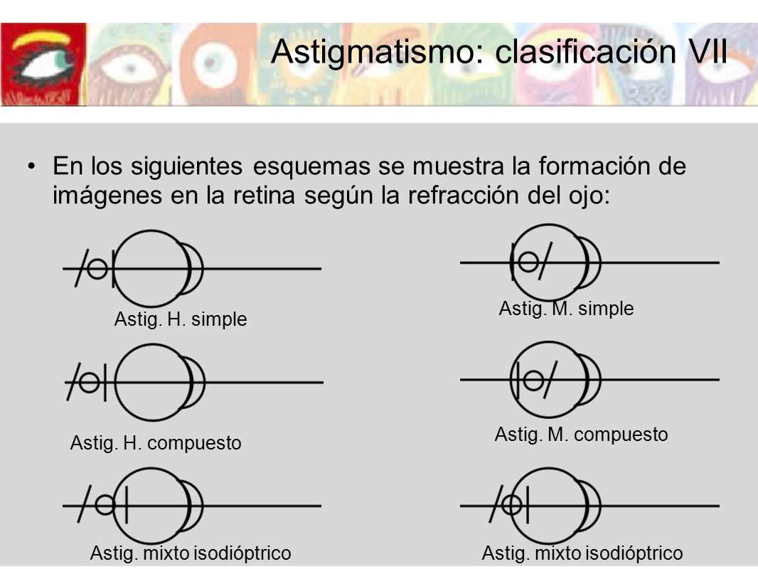 ASTIGMATISMO El objetivo de este apartado es: Determinar los criterios de  prescripción en los casos de sujetos con astigmatismo. Este apartado está  estructurado. - ppt descargar