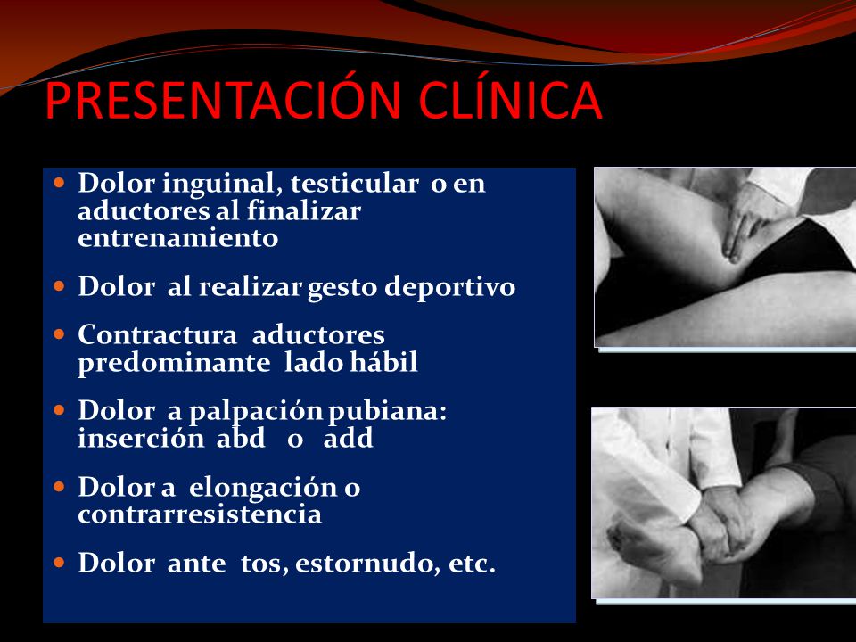 PRESENTACIÓN CLÍNICA Dolor inguinal, testicular o en aductores al finalizar entrenamiento. Dolor al realizar gesto deportivo.
