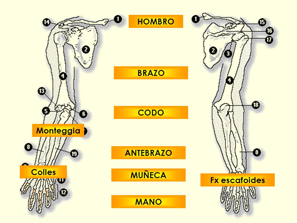HOMBRO BRAZO CODO Monteggia ANTEBRAZO Colles MUÑECA Fx escafoides MANO