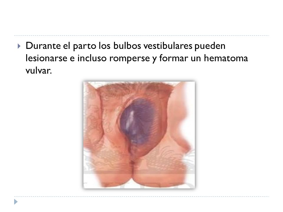 Durante el parto los bulbos vestibulares pueden lesionarse e incluso romperse y formar un hematoma vulvar.