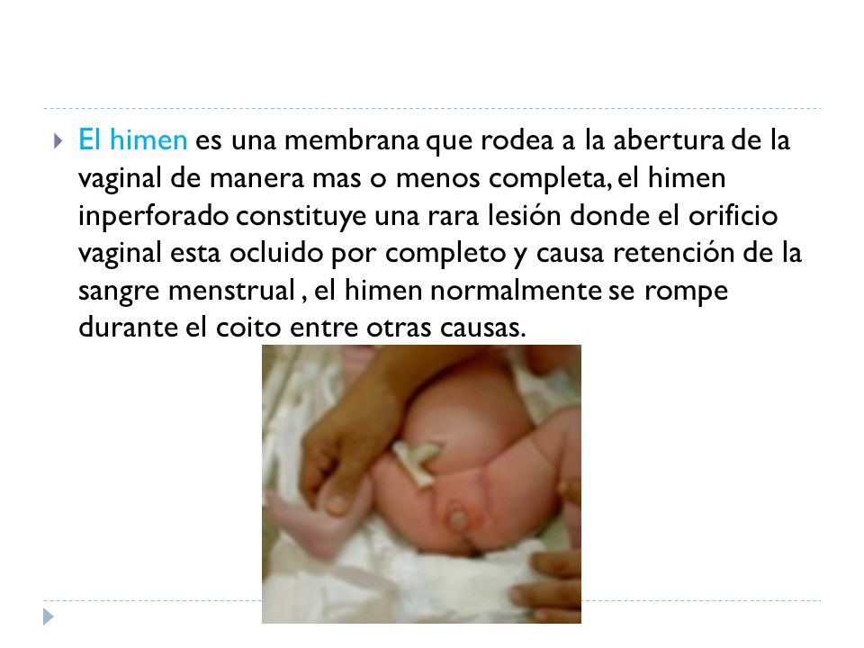 El himen es una membrana que rodea a la abertura de la vaginal de manera mas o menos completa, el himen inperforado constituye una rara lesión donde el orificio vaginal esta ocluido por completo y causa retención de la sangre menstrual , el himen normalmente se rompe durante el coito entre otras causas.